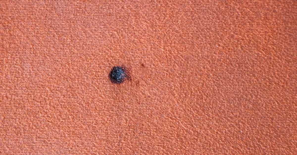 喫煙による借主の過失でタバコの焼け穴があるカーペット